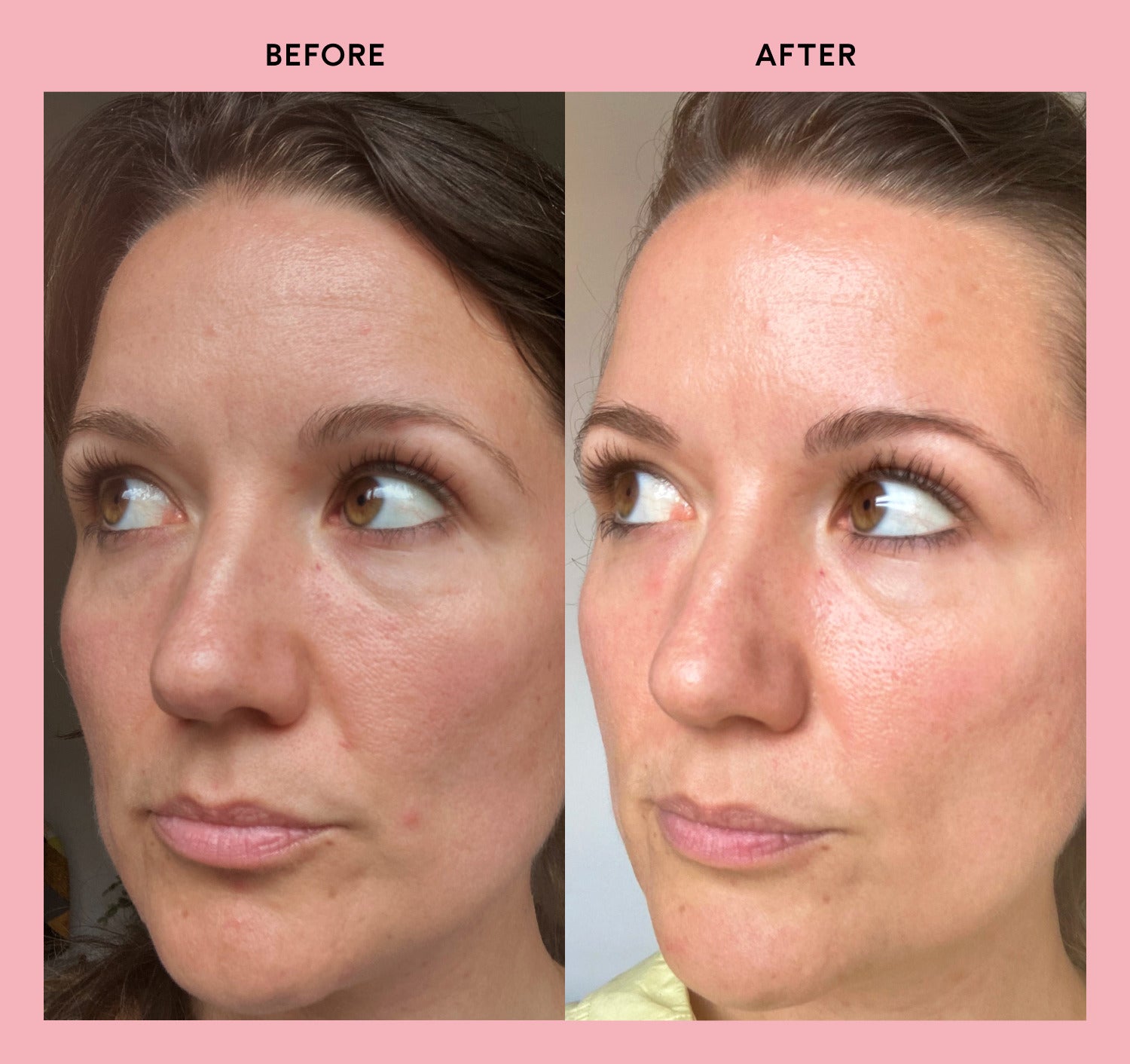 Can colageno marino truly make your skin look younger? (Find out how it helps keep skin firm and glowing)