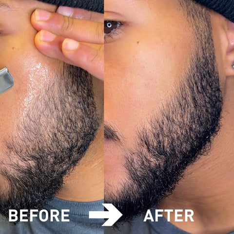 Shaving for black skin: how to do it right? (Get your best, smooth shave now)