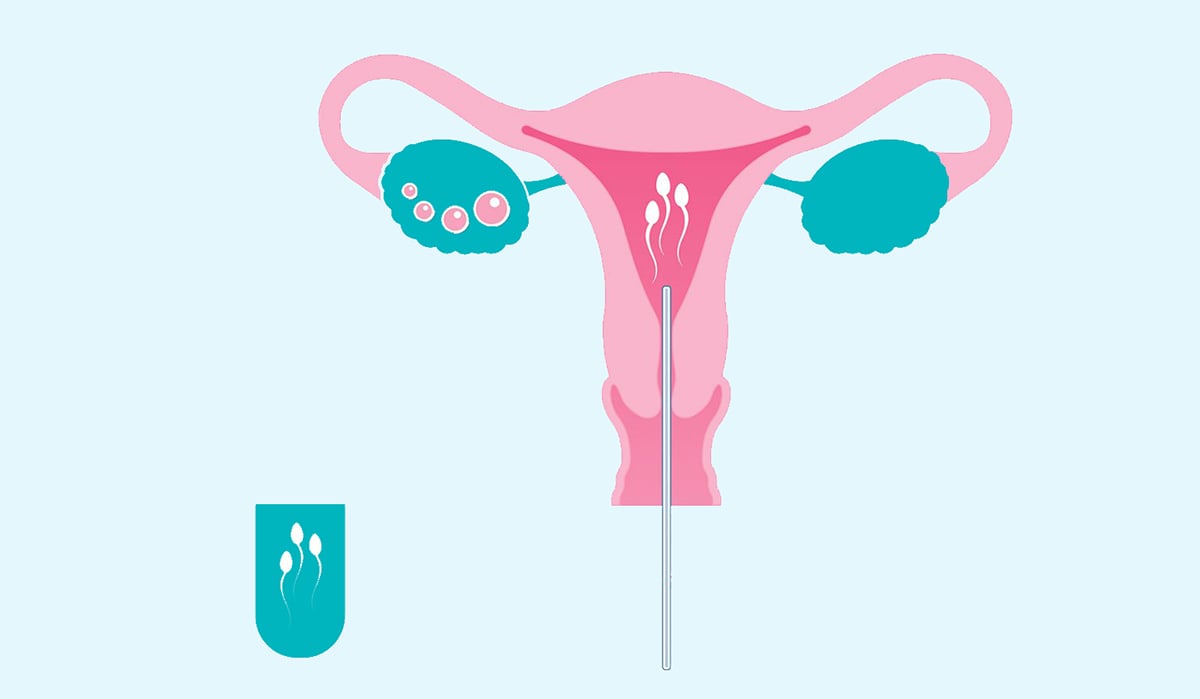 What is a hostile womb exactly? (Understand its impact on fertility and what you can do now)