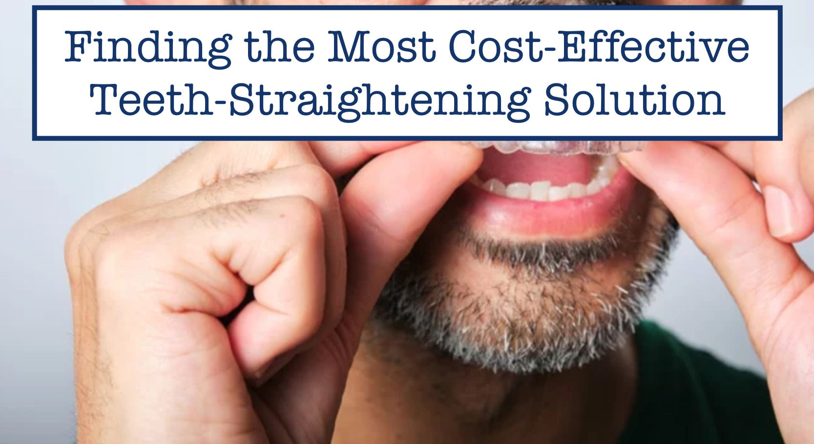 Want the cheapest way to straighten teeth? We reveal practical solutions that are kind to your wallet.