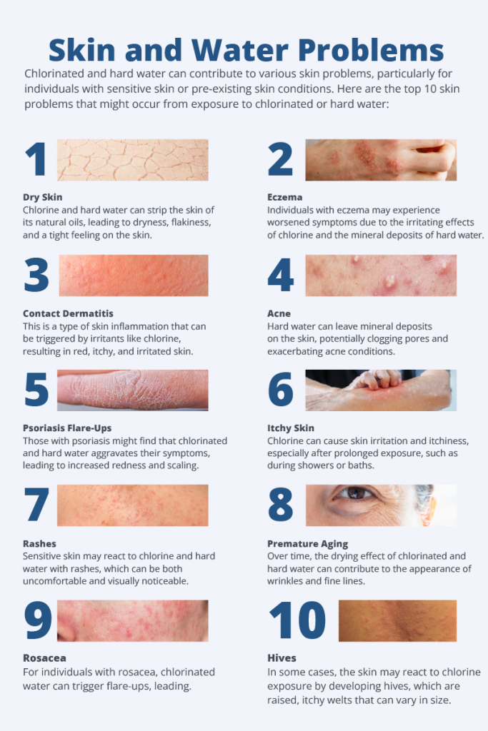 Is it true, does pool chlorine kill fungus on skin? What experts say about treating skin problems this way.