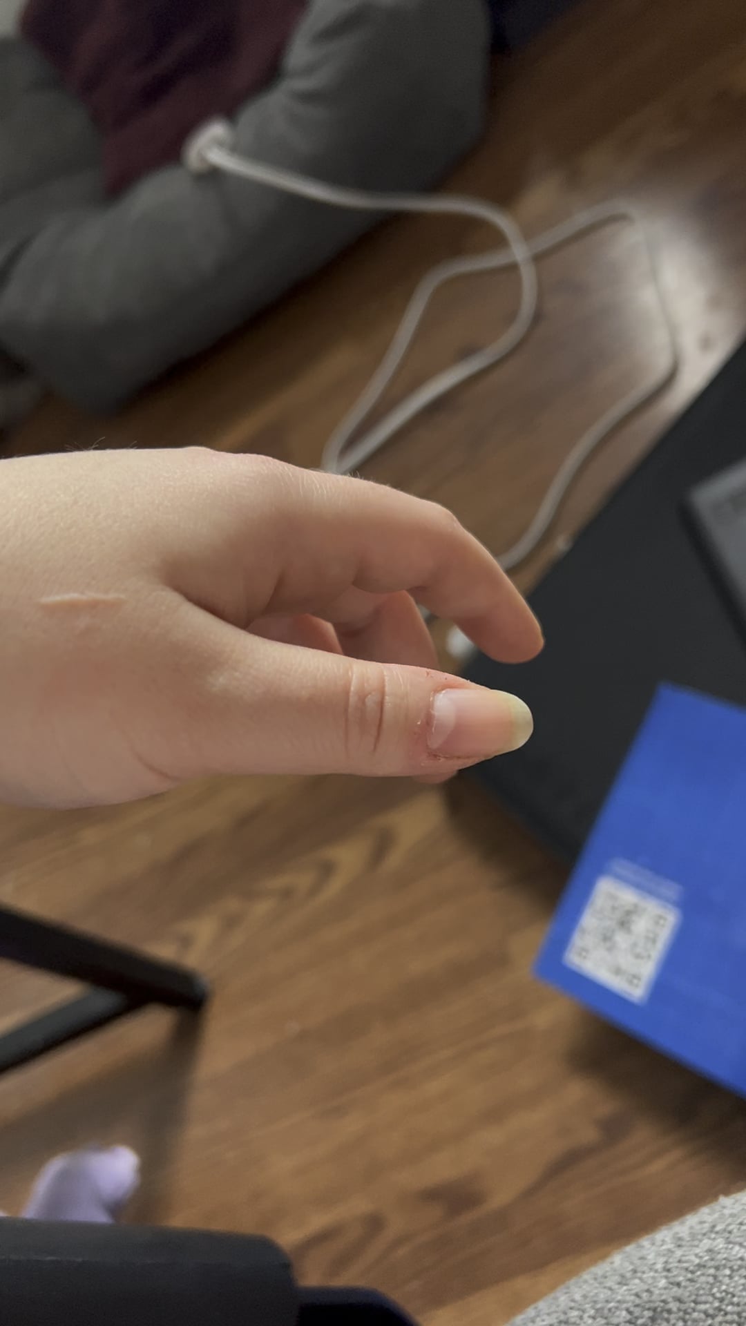 How to Stop Thumb from Twitching: 5 Shocking Mistakes You Didn’t Know You Made