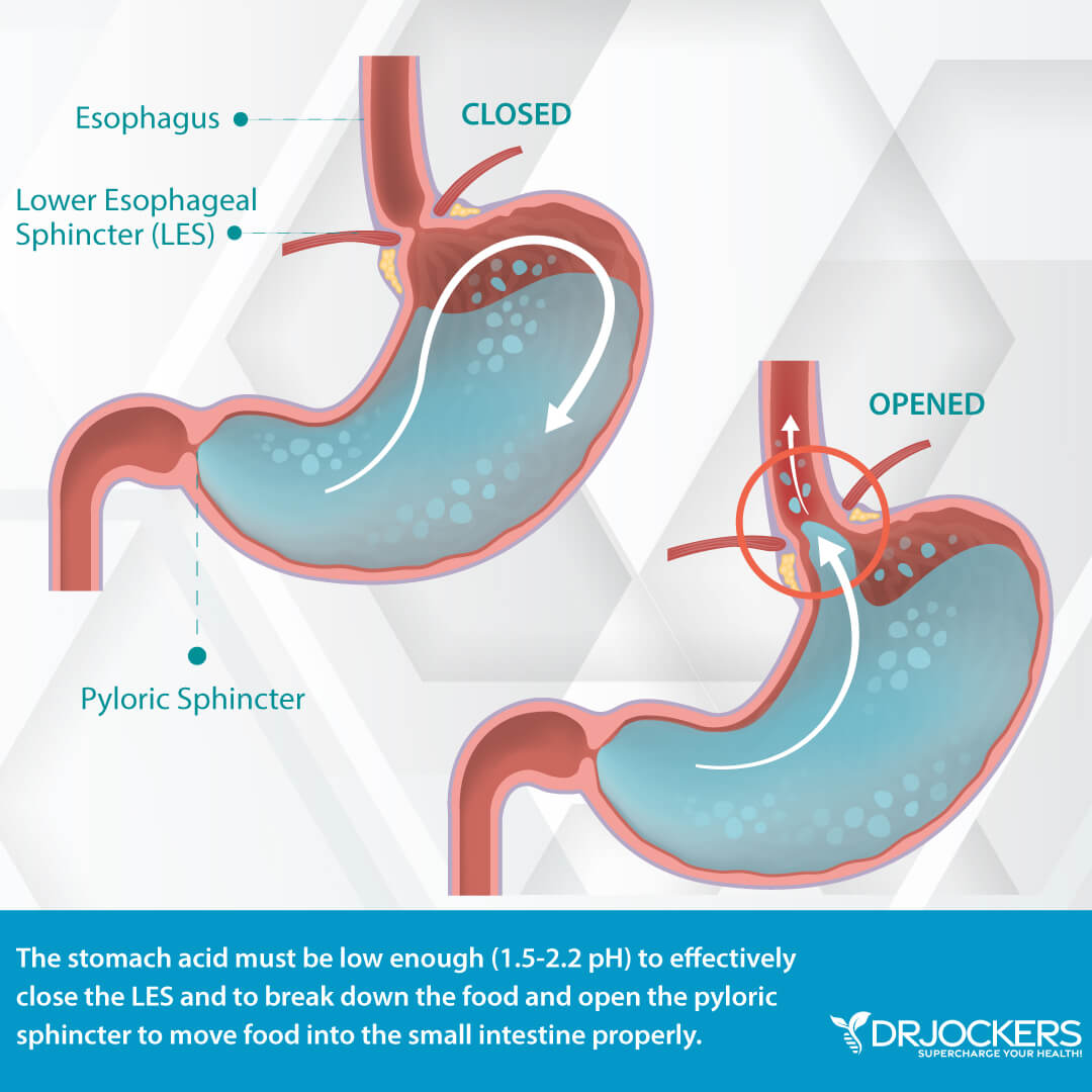 Can GERD Cause Stomach Bloating? Discover the Hidden Link and How to Stop It Now