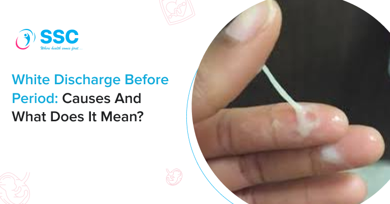 Why white discharge happens before your period? Key facts shared.