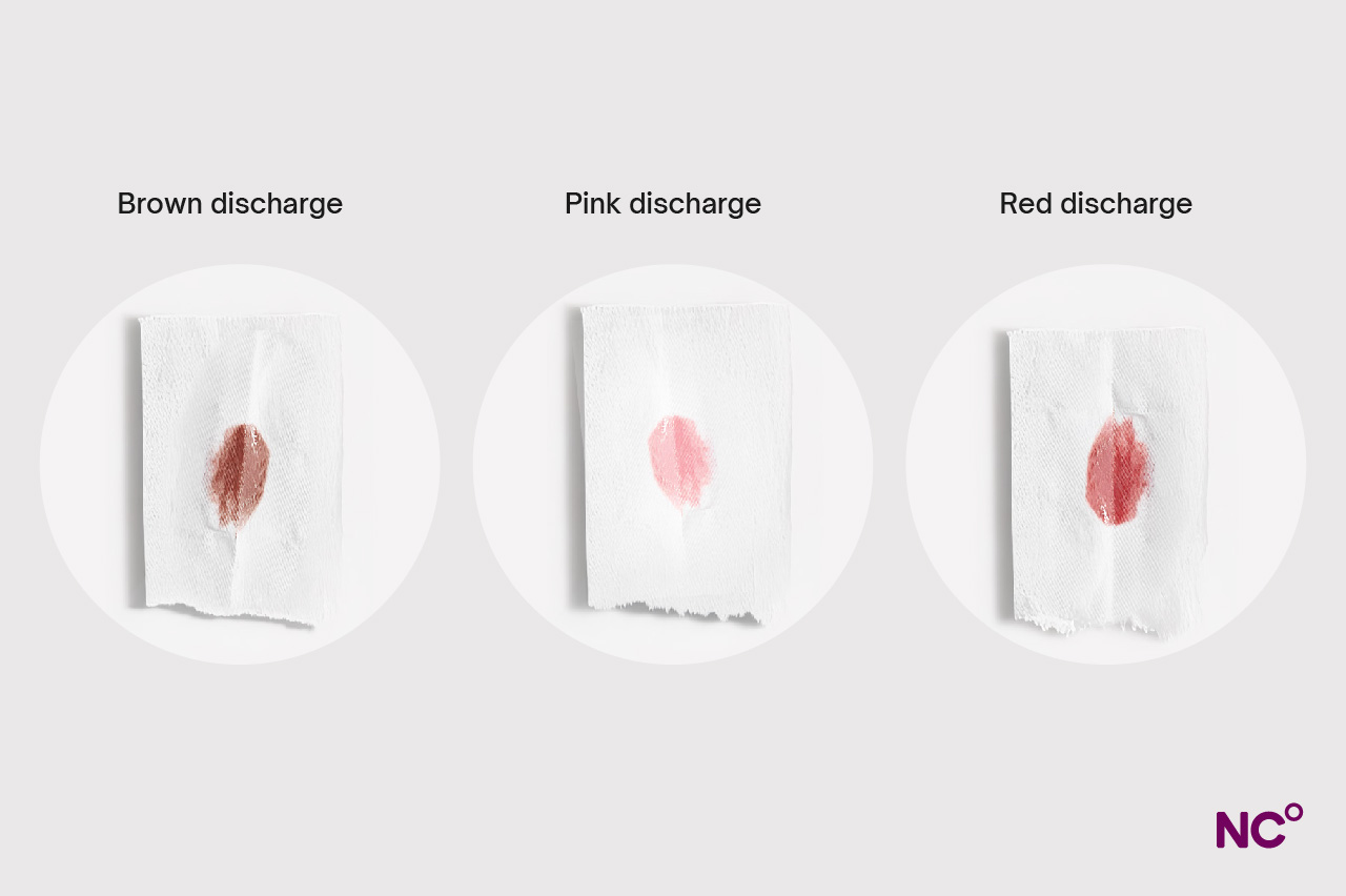 Brown Discharge Before Your Period: Simple Ways to Stop It Naturally