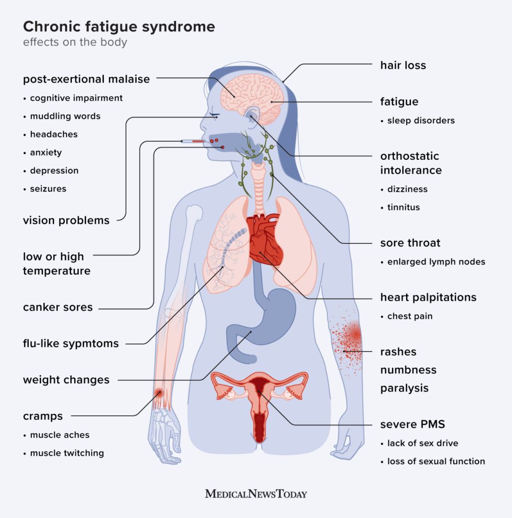 Doctors list common medical reasons for chronic fatigue every patient should know today.