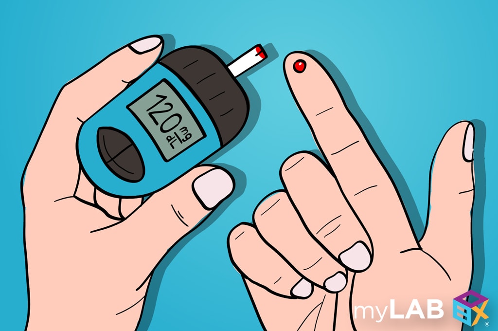 Self diabetes test vs lab test? Which way is best for you?