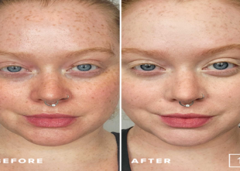 Which pomegranate face mask is truly the best for you? Find your perfect match for amazing clear skin!