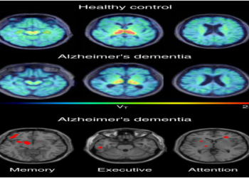 Is it true can levodopa help with meth drug addiction? Learn more about this potential treatment option today.