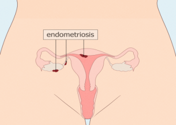 Is it safe, can I have a bath on my period? Experts explain the simple truth for you.