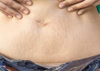 Summer Weight Loss Trap: Why You’re Gaining Fat Instead of Losing It in the Heat