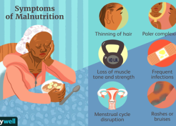 Chronic Fatigue Reasons Diet? 5 Foods Making You Tired Everyday